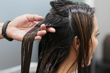 HAIR LOSS TREATMENT IN HYDERABAD