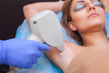 Laser Hair Removal in Hyderabad